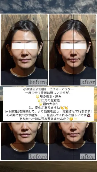 💎後悔させない小顔 矯正💎イトヤマ🌱のエステ・リラクイメージ