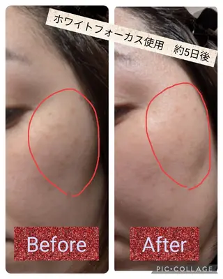 iVan❤️ shioriのエステ・リラクイメージ