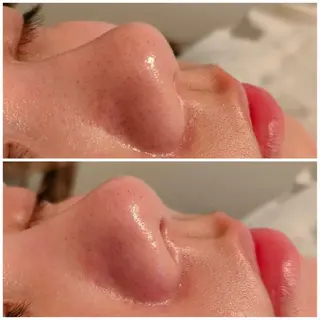 アイブロウ B&H所属・頭痛•肩こり専門/ 眉サロンB&H心斎橋のエステ・リラクイメージ