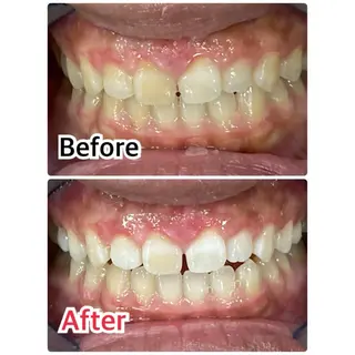 プラチナムビューティー柏所属・【歯科提携】柏ホワイ トニングスタイルのその他イメージ