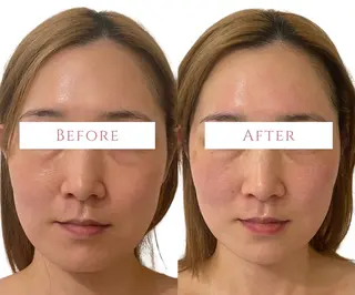 小顔/たるみ/黒ずみ除去専門サロン/SONA 大和西大寺店所属・【小顔専門看護師 サロンSONA】のエステ・リラクイメージ