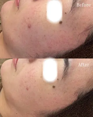 BELLIS HUIT所属・肌質改善｜体質改善ꕤ BELLISHUITのエステ・リラクイメージ