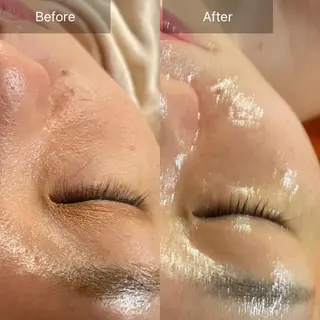 Mandarin Orange所属・毛穴から始める肌メン テマンダリンオレンジのエステ・リラクイメージ