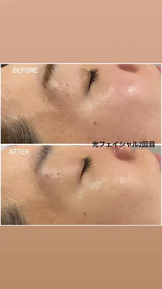 毛穴洗浄・痩身・脱毛 /アルカンジュのエステ・リラクイメージ