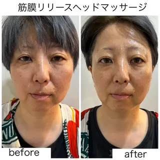 leolo武蔵浦和 肌質改善&脱毛のエステ・リラクイメージ