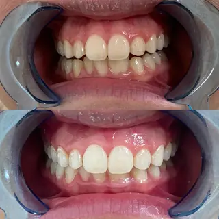 藤本 真心のネイルデザイン