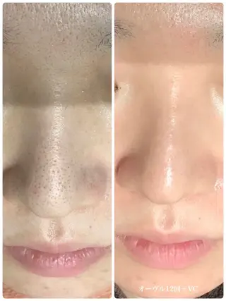 Bebe×DiDiA 野々市市役所前店所属・Bebe×DiDiA 野々市市役所前店のエステ・リラクイメージ