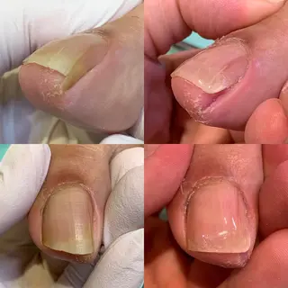 ネイル 東京巻き爪アカデミー所属・東京巻き爪 アカデミーのエステ・リラクイメージ