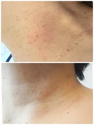 バストアップ専門/ ボディケア/小顔のエステ・リラクイメージ