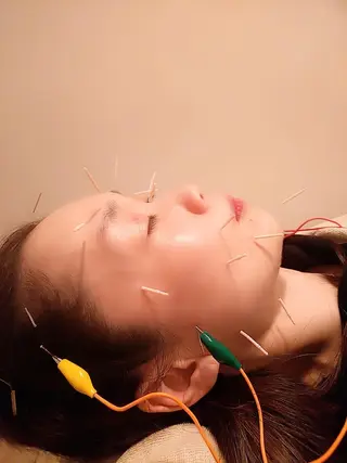 むくみたるみ専門☆ 美容鍼・小顔矯正のエステ・リラクイメージ