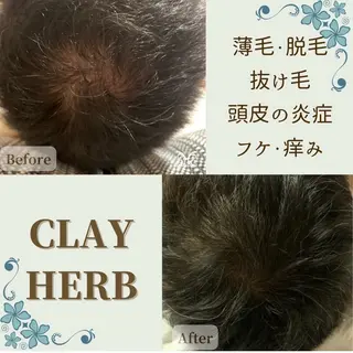 VIKI BEAUTY  クレイハーブピーリング・美肌脱毛専門店所属・VIKI BEAUTYのエステ・リラクイメージ