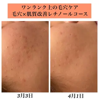 Bellesthe （ベルエステ）のエステ・リラクイメージ