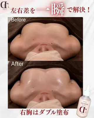 バストケア&バストア ップ専門店canyのその他イメージ