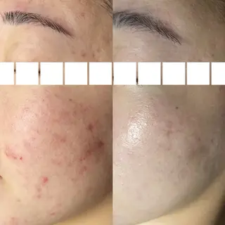 beauty salon　REBORN所属・REBORN所属 小山のエステ・リラクイメージ
