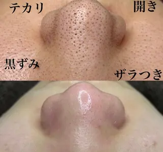 アンジュネス 池袋のマツエク・マツパデザイン