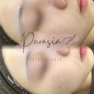 🪞Purasia. 🫧韓国肌管理💎のエステ・リラクイメージ