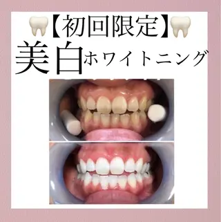 メディカルエステ マドンナのエステ・リラクイメージ