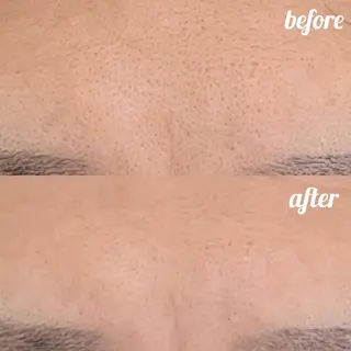 メンズ 小顔・ツルツル素肌 ハリステリアのエステ・リラクイメージ