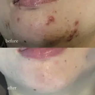 EARNEST大阪 心斎橋【韓国肌管理】のエステ・リラクイメージ