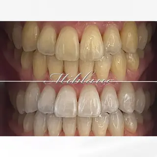 ホワイトニング MIBLANC上野店のその他イメージ