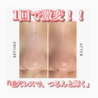 WhiteAqua 博多店　Erikoのエステ・リラクイメージ