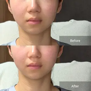 nail RiRi アトレナチュラのエステ・リラクイメージ