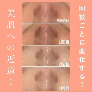 Meow！～トラブル肌専門ピーリング＆脱毛サロン～所属・トラブル肌改善🏥 Meow！🫧🫧のエステ・リラクイメージ