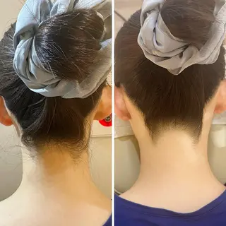 うなじ脱毛/美肌脱毛 LABELのエステ・リラクイメージ