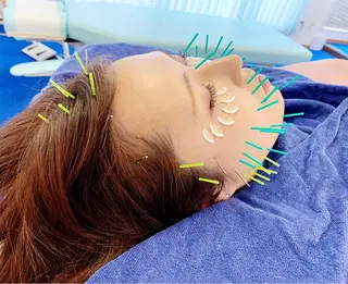 小顔美容鍼専門サロン 渋谷YZのエステ・リラクイメージ