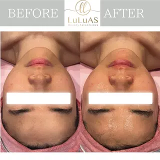 ルルアス GINZAのエステ・リラクイメージ