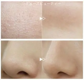 ミューズビューティー所属・山本 ゆりのエステ・リラクイメージ