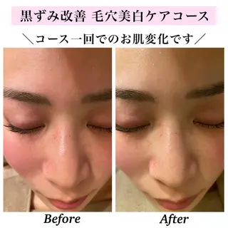 Bellesthe (ベルエステ)のエステ・リラクイメージ