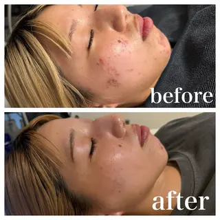 医療提携La Luna Keiのエステ・リラクイメージ