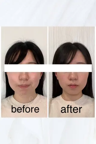 小顔と ヘッドスパのお店のエステ・リラクイメージ