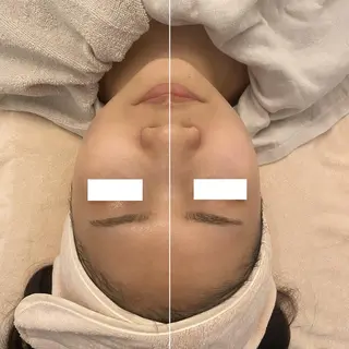 ✨美肌水光✨ アトリエリュバンのエステ・リラクイメージ