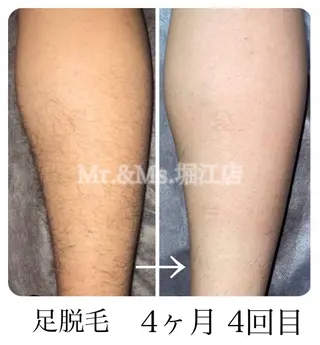 Mr.&Ms.脱毛 YUNAのエステ・リラクイメージ