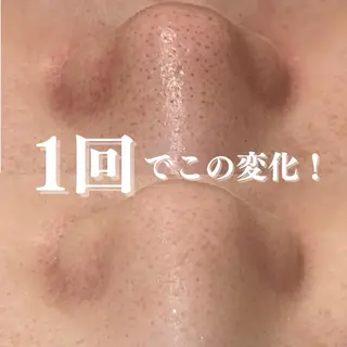 憧れの韓流すっぴん肌 🤎肌管理専門エステのエステ・リラクイメージ