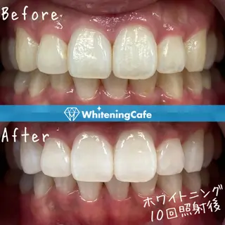 ホワイトニングカフェ神戸元町店所属・ホワイトニングカフェ 神戸元町店のエステ・リラクイメージ