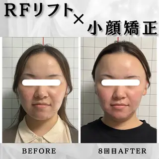 小顔矯正専門店 ❤️池田 桃花のエステ・リラクイメージ