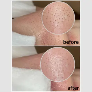 マツエク・マツパ 韓国肌管理 【毛穴専科】のエステ・リラクイメージ