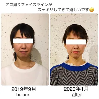 セミロング ネイル マツエク・マツパ 小顔矯正専門サロンジュマリ所属・町田 淳子のエステ・リラクイメージ