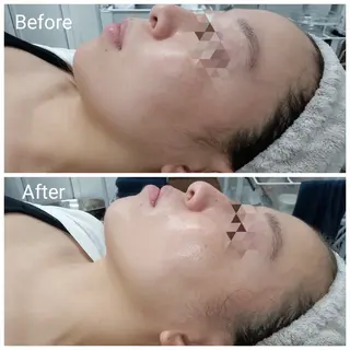 肌質改善Beauty salon Renのエステ・リラクイメージ