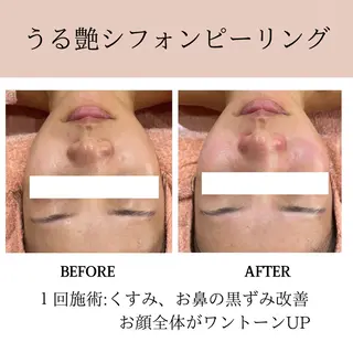 肌質改善専門サロン Bellmi/心斎橋のエステ・リラクイメージ