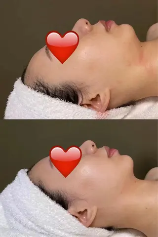 OPREA 千種店のエステ・リラクイメージ