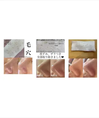 private salon  Dea_maris シュガーリング＆パーソナルボディケア所属・シミ改善・韓国肌管理 ボディメイク痩身のその他イメージ