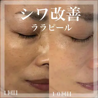 WHITE AQUA 北千住店のエステ・リラクイメージ