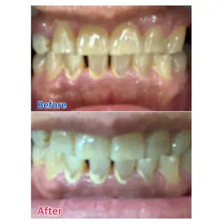 MBEAUTYSALON 千葉店・京成大久保所属・Melty 輝のその他イメージ