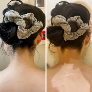 うなじ脱毛/美肌脱毛 LABELのエステ・リラクイメージ