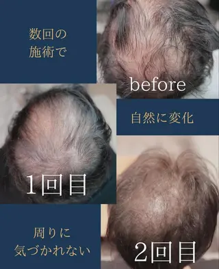 メンズ W eye+東口店/ SCALP INKのマツエク・マツパデザイン
