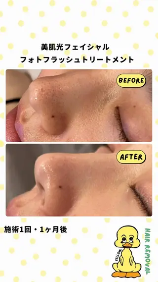 yellow.所属・yellow💛【 脱毛&フェイシャル】のエステ・リラクイメージ